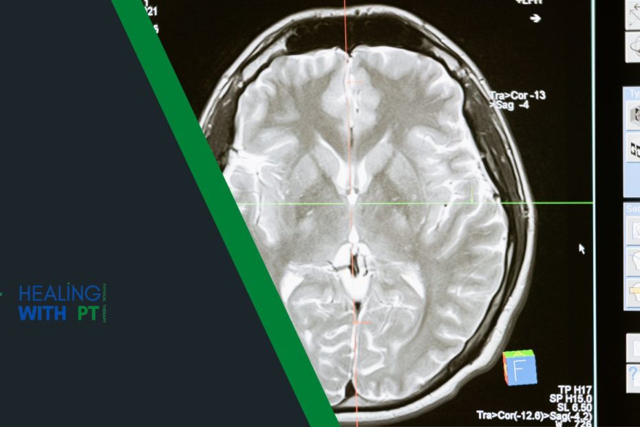 What’s Neurological physiotherapy? Scope, Treatment, Exercises